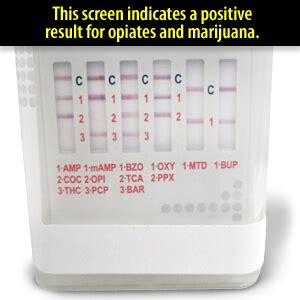 A urine drug test was requested, and the results came back positive for benzodiazepines, opioids and ecstasy/MDMA. The family doctor confirmed the patient's voluntary intake of clorazepate 10 mg the previous day in addition to chlordiazepoxid 10 mg daily on a chronic basis, while the ED doctors stated that they had administered fentanyl …